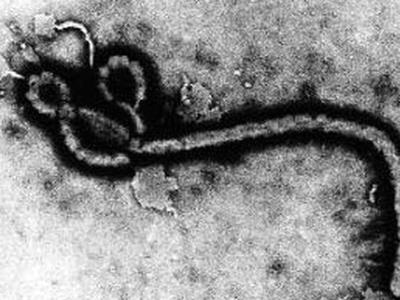ebola11