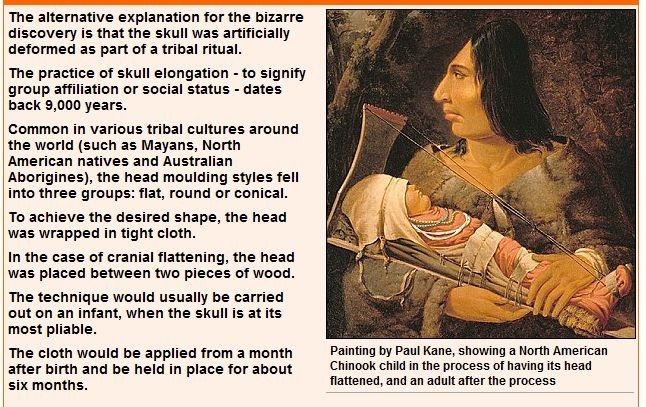 在婴孩时代以较残忍不人道的手法，用布和木板将婴孩头部夹到畸形。（网络截图）
