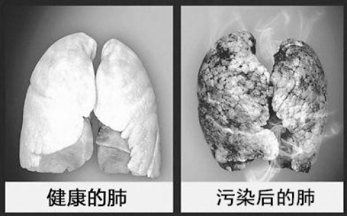 复旦大学在2013年对PM2.5进入肺组织后的变化进行试验（网络图片）