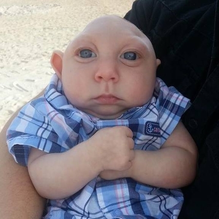 13个月大的无脑儿杰克逊‧布尔现在已经会说“妈妈”、“爸爸”。(杰克逊‧布尔的Facebook)