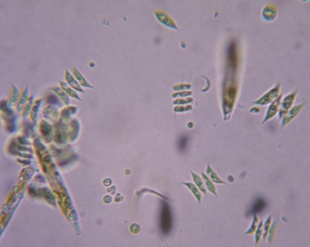 绿藻：显微镜下才能看清其结构的一种生物。（维基百科）