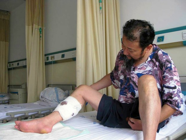 2016年9月12日，山东省村民姜善珠怀疑在法院外遭枪击受伤，目前仍在医院留医。（姜善珠妻子提供）
