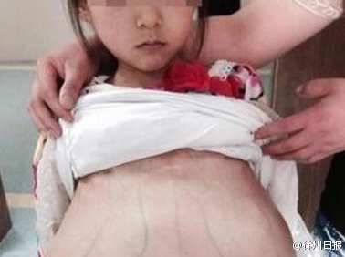 网传“徐州一名12岁女孩在医院做产检，疑似被拐卖”的调查情况。