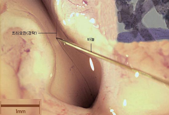 韩国研究人员在连结兔子大脑与脊髓部位发现经络管道